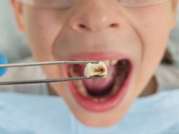 Best Emergency Pediatric Dental Care in Grove City, FL